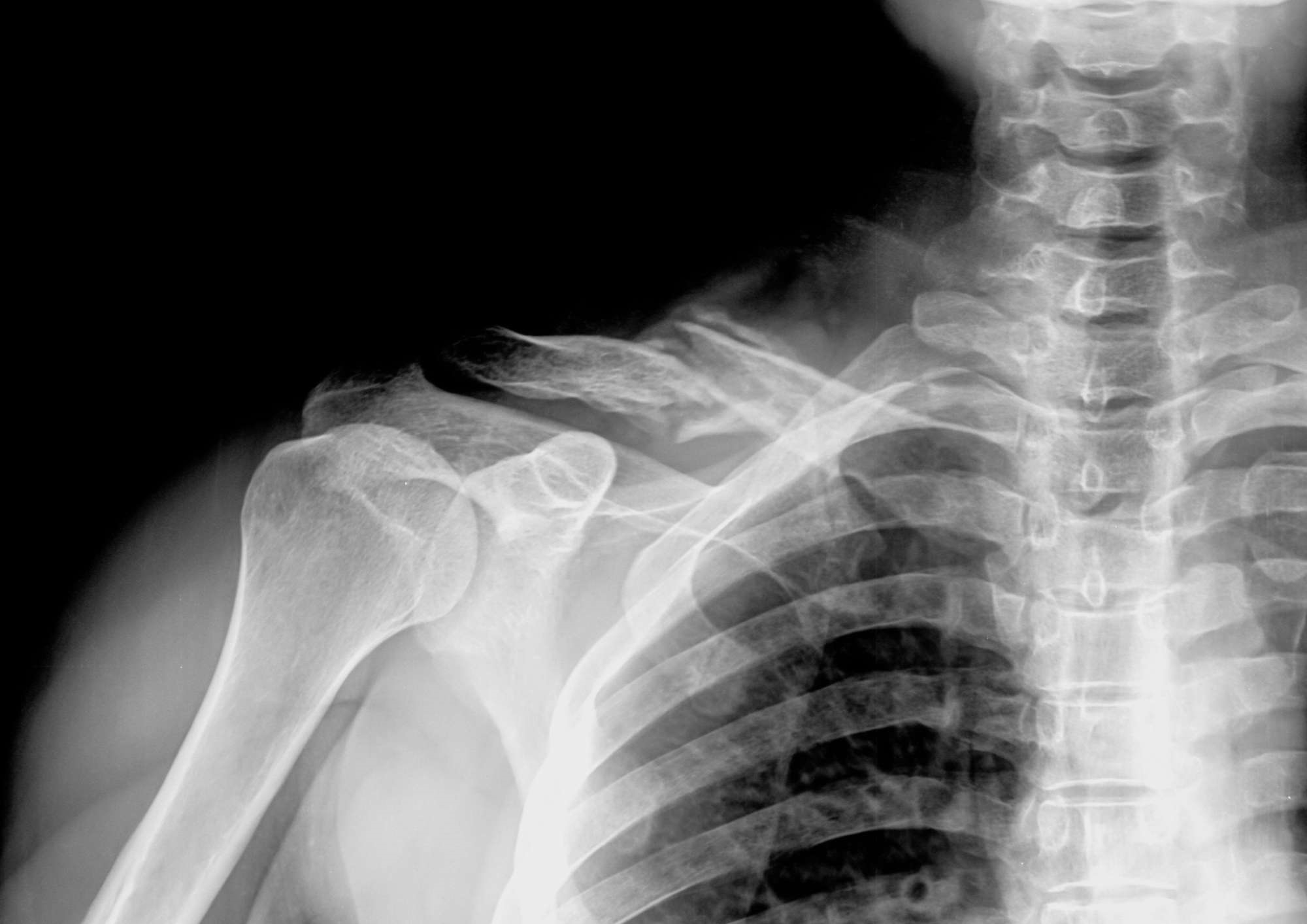 X-Ray Scan | Pall Mall X-Ray Scan | Pall Mall